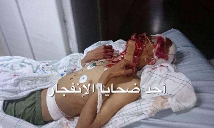 FILE-20160217-0358U6RWK32HYVTW